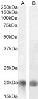 anti-CD258 / LIGHT antibody