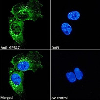 anti-GPR17 antibody
