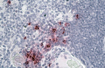 anti-alpha Defensin 1 antibody