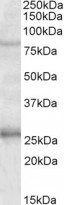 anti-GPRIN3 antibody