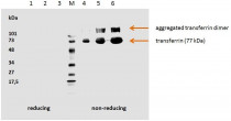 anti-Transferrin antibody [HTF-14] (low endotoxin)