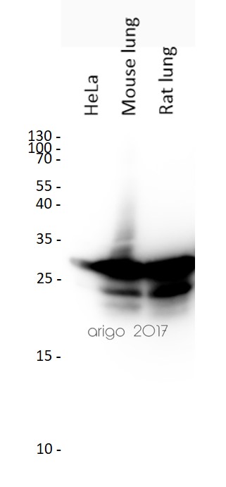 anti-HMGB1 antibody