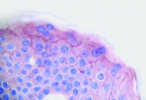anti-PDGF AA antibody