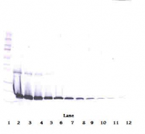 anti-IL1RA antibody