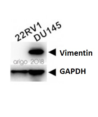 Carcinoma / Sarcoma Antibody Duo