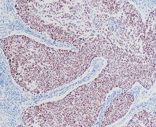 anti-p63 antibody [SQab1893]