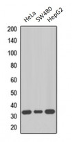 anti-MKI67IP / NIFK antibody