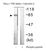 anti-IKK beta phospho (Tyr199) 抗体 (ARG66584) - arigobio