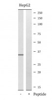 anti-SIX2 antibody