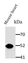 anti-Desmin antibody