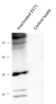 anti-Enterovirus 71 antibody
