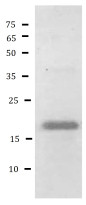 Mouse CD254 / RANKL recombinant protein (Active) (His-tagged, C-ter)