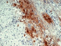 anti-beta Endorphin antibody [B31.15]