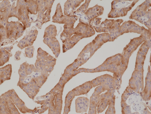Immunohistochemical