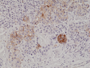 Immunohistochemical