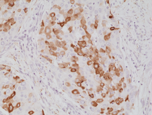 Immunohistochemical