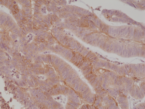 Immunohistochemical