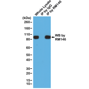 Immunoprecipitation
