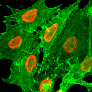 Immunocytochemical