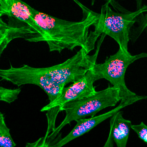 Immunocytochemical