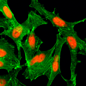 Immunocytochemistry