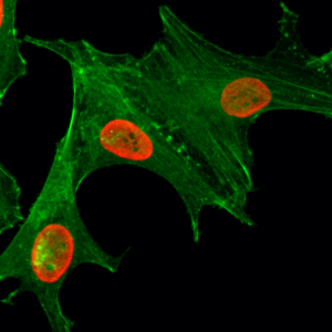 Immunocytochemistry