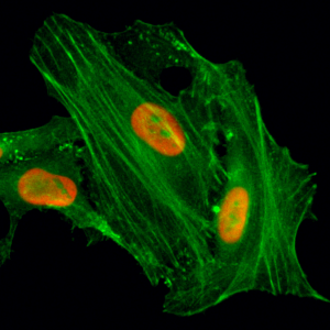 Immunocytochemistry