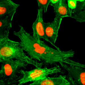 Immunocytochemical