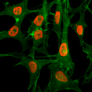 Immunocytochemistry