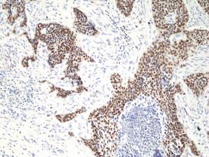 Immunohistochemical