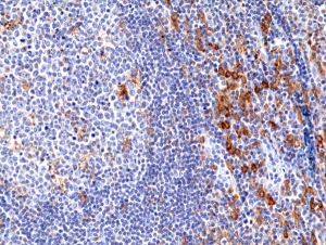 Immunohistochemical