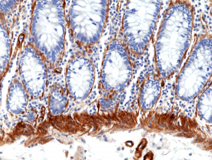 Immunohistochemical