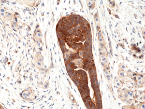 Immunohistochemical