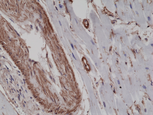Immunohistochemical