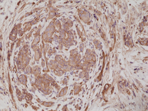 Immunohistochemical