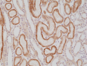 Immunohistochemical