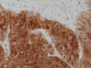 Immunohistochemical