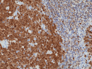 Immunohistochemical