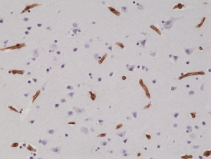 Immunohistochemical