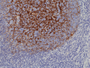 Immunohistochemical
