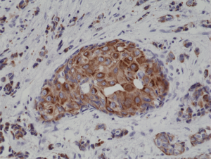 Immunohistochemical
