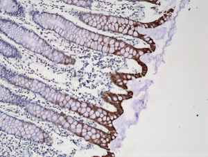 Immunohistochemical