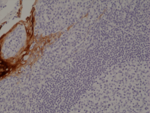 Immunohistochemical