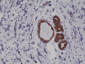 Immunohistochemical
