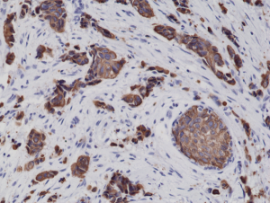 Immunohistochemical