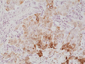 Immunohistochemical