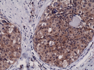 Immunohistochemical
