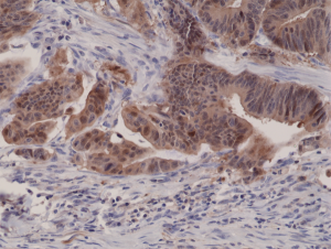 Immunohistochemical