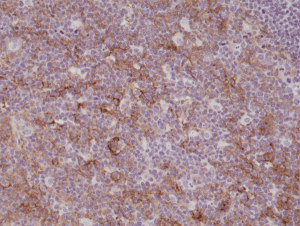 Immunohistochemical