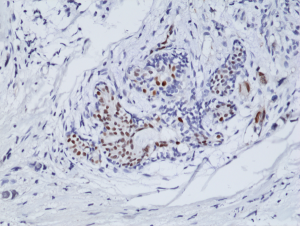 Immunohistochemical